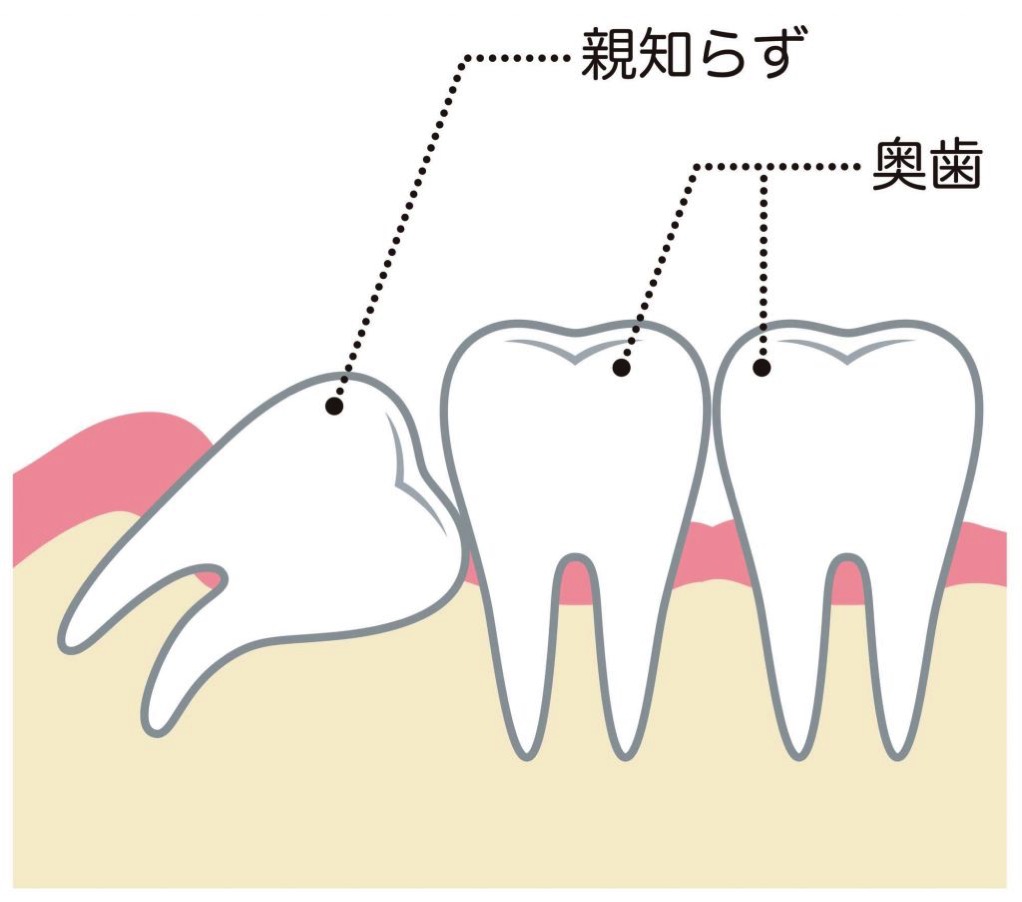 Pixta 19089454 M 1024x903